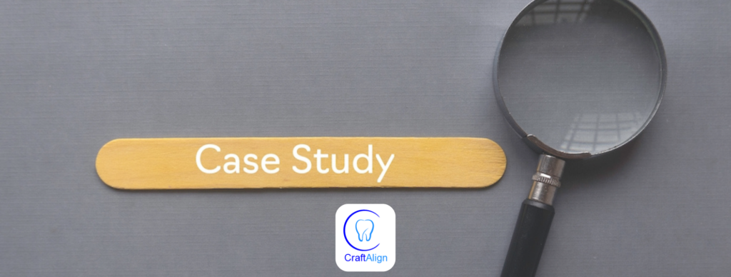 Case Study: Successfully Implementing 3D Printing for Clear Aligners in a Clinic